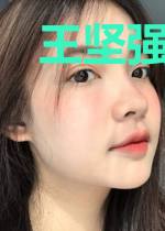 王坚强林巧儿